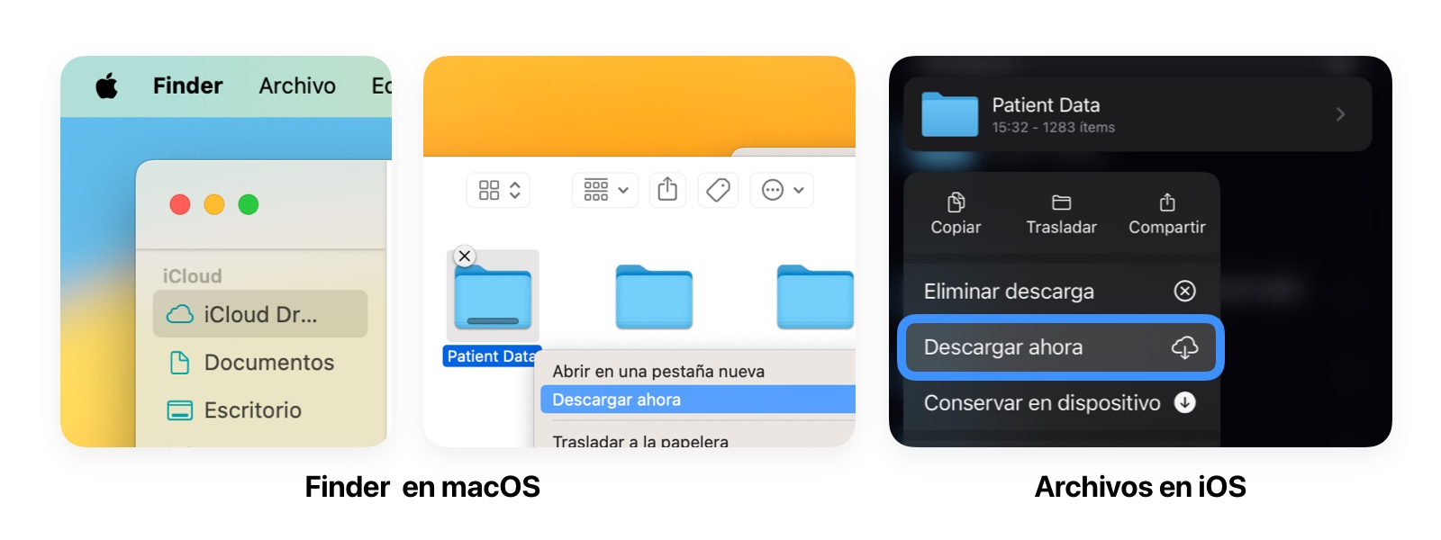 Cómo forzar descarga de archivos de OrthoKit en iCloud